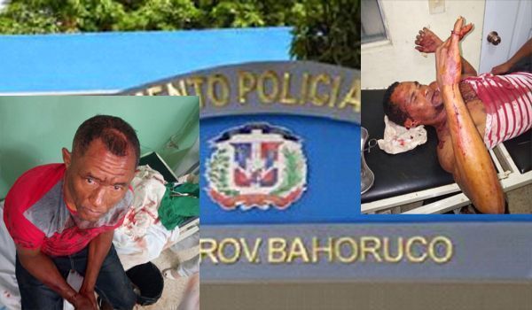 Cuatro hombres resultan heridos en hechos separados en Neiba y Tamayo
