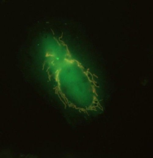 Las mitocondrias rotas usan proteínas ‘come yo’ para convocar a sus verdugos