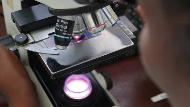 El 10 por ciento de las muertes en pacientes con VIH se debe a infección por criptococo