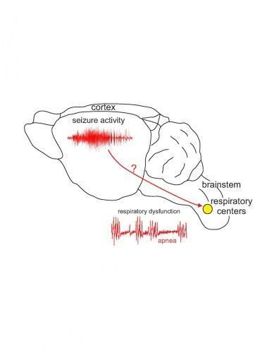 Epilepsia y muerte súbita ligadas a mal gen.