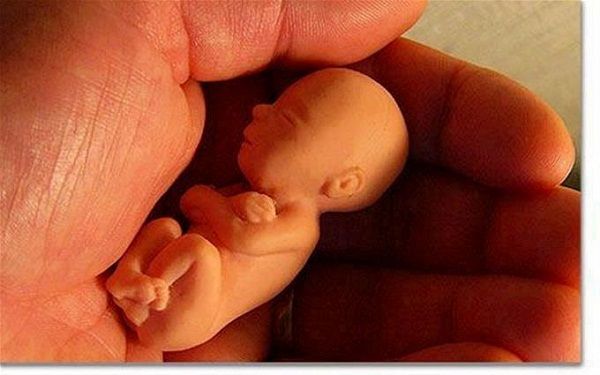 Suspende temporalmente ley restrictiva sobre el aborto en Missouri