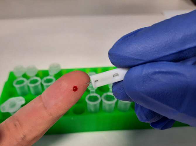 Un nuevo test de anticuerpos para COVID-19 logra mayor sensibilidad al basarse en la proteína ‘spike’ completa