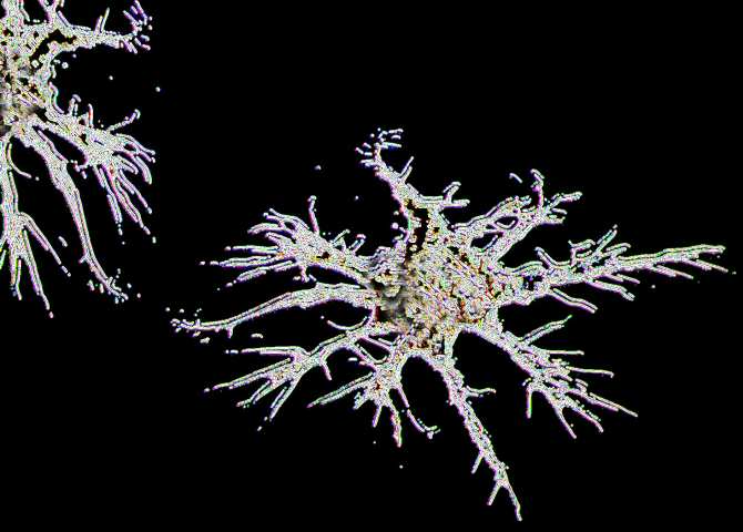 Logran revertir daños causados por la esclerosis lateral amiotrófica