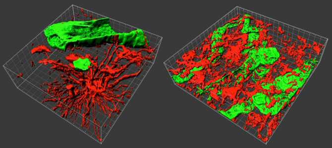 Biopsias en 3D para entender mejor los tumores cerebrales