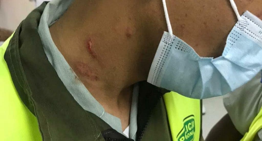 Apresan a dos hombres acusado de agredir a varios miembros de la DIGESETT