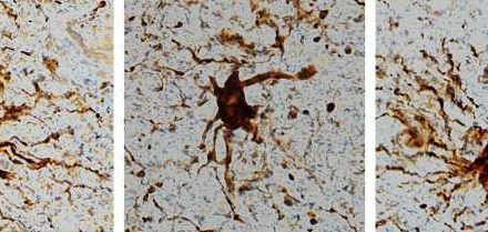 Genes que se vuelven más activos tras la muerte y células que crecen mucho en el difunto
