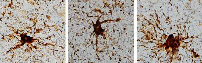 Genes que se vuelven más activos tras la muerte y células que crecen mucho en el difunto