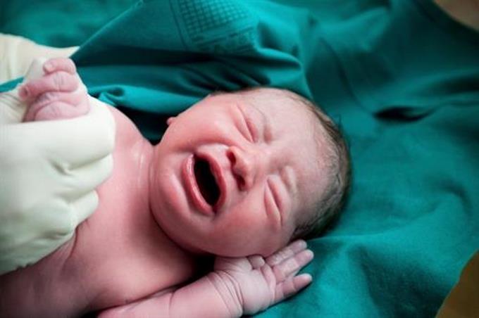 El uso de la epidural en el parto no está relacionado con el riesgo de autismo, según un estudio