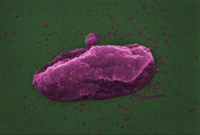 Descubren cómo mata un valioso antibiótico de último recurso