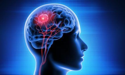 Nuevos y efectivos métodos para tratar tumores cerebrales