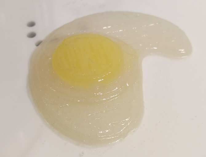 Impresora 3D que produce alimentos para pacientes con dificultades para comer