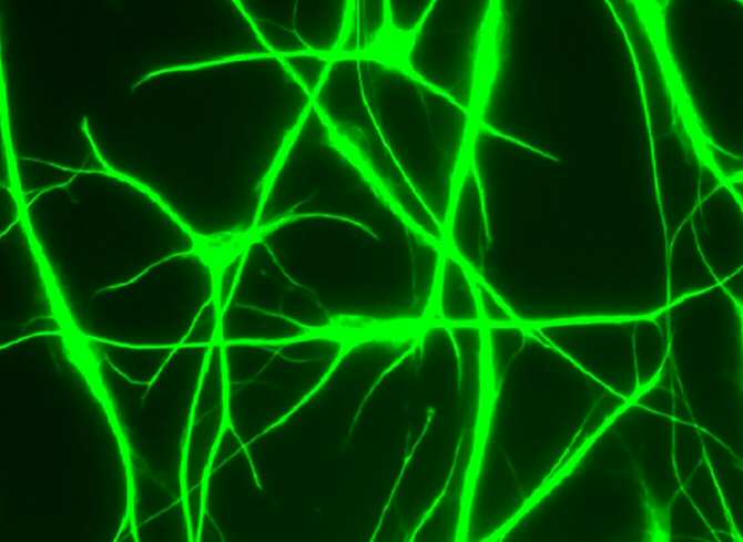 Descubren importantes diferencias entre las células cerebrales humanas y las de ratón