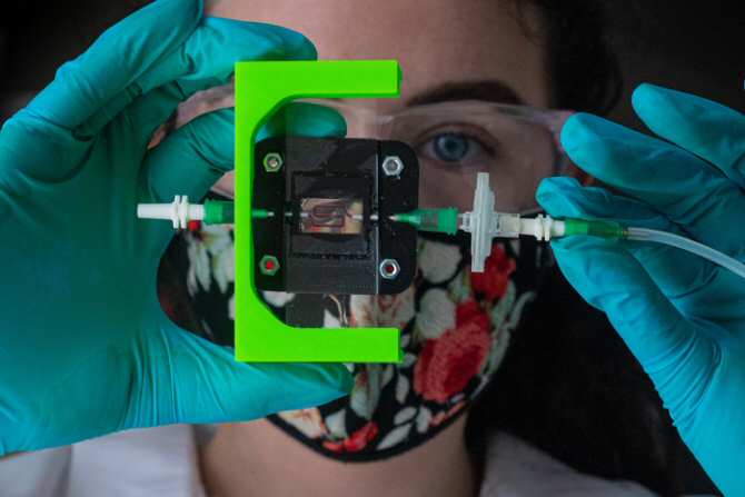 Hacia un implante para producir insulina en pacientes de diabetes tipo 1