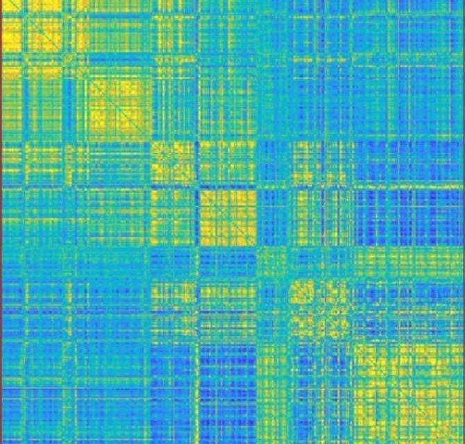 La «huella dactilar» del cerebro de una persona