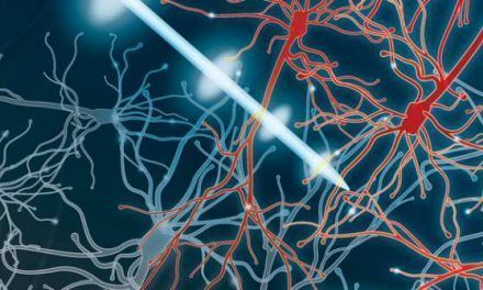 Estimulación cerebral profunda para tratar la enfermedad de Parkinson