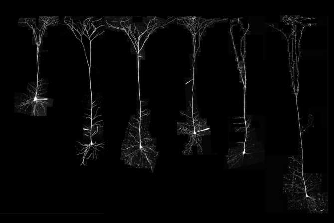 Una diferencia clave entre las neuronas humanas y las de otros mamíferos