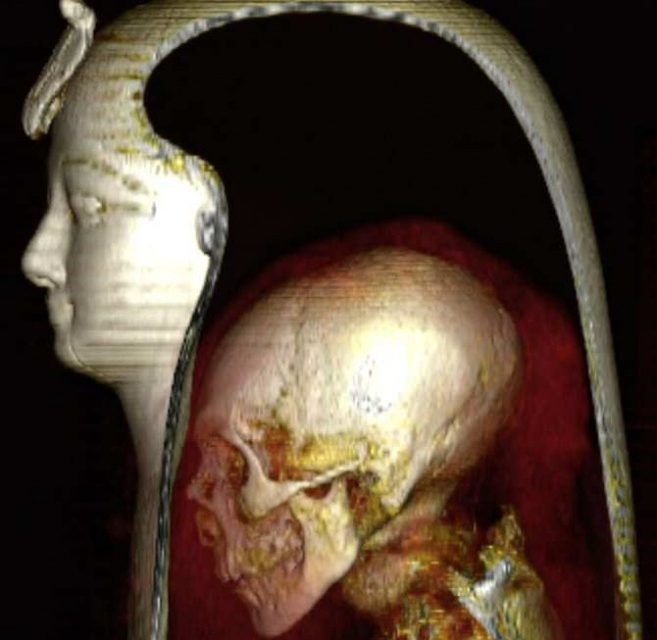 La momia del faraón Amenofis I bajo el vendaje