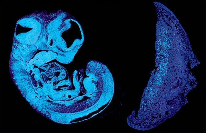 Comunicación entre el feto y la placenta