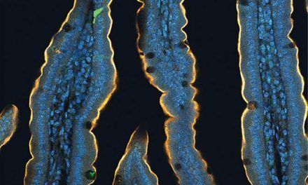El misterio de la distinción entre azúcar y edulcorantes artificiales