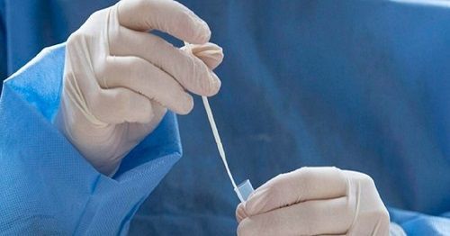 Perú emite alerta epidemiológica por alza de contagios por variantes ómicron