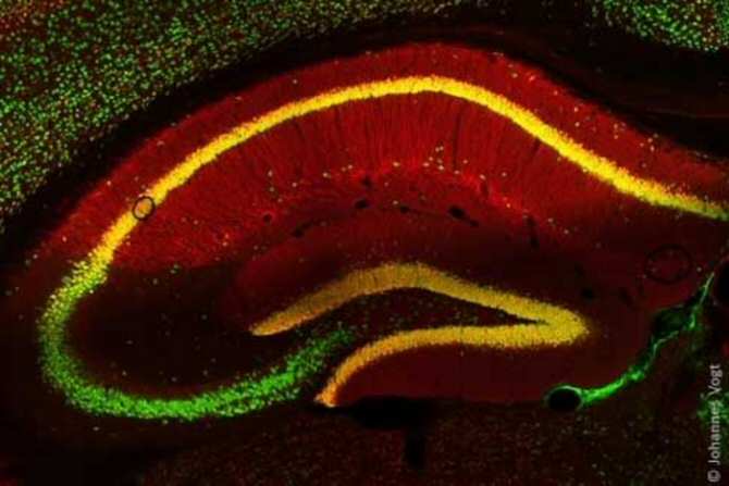 Las neuronas del hambre al descubierto