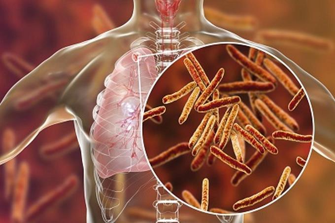 La lucha contra el VIH, la tuberculosis y la malaria salva 50 millones de vidas en 20 años