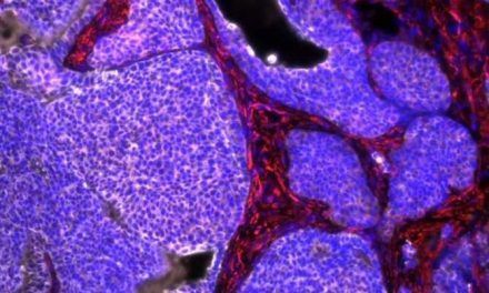 Nanopartículas que mejoran inmunoterapias contra el cáncer