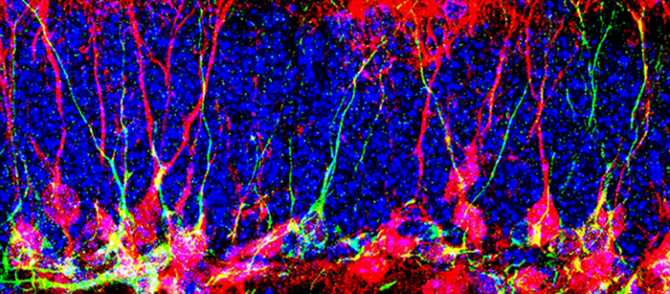 Descubren cómo hacer que se generen nuevas neuronas en un cerebro adulto