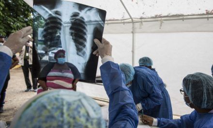 El país registra 3,693 casos de varicela en lo que va de año
