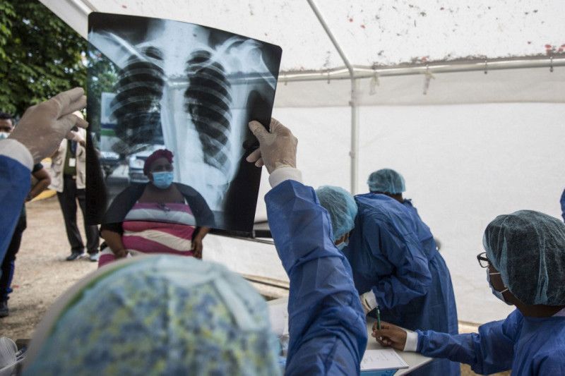 El país registra 3,693 casos de varicela en lo que va de año