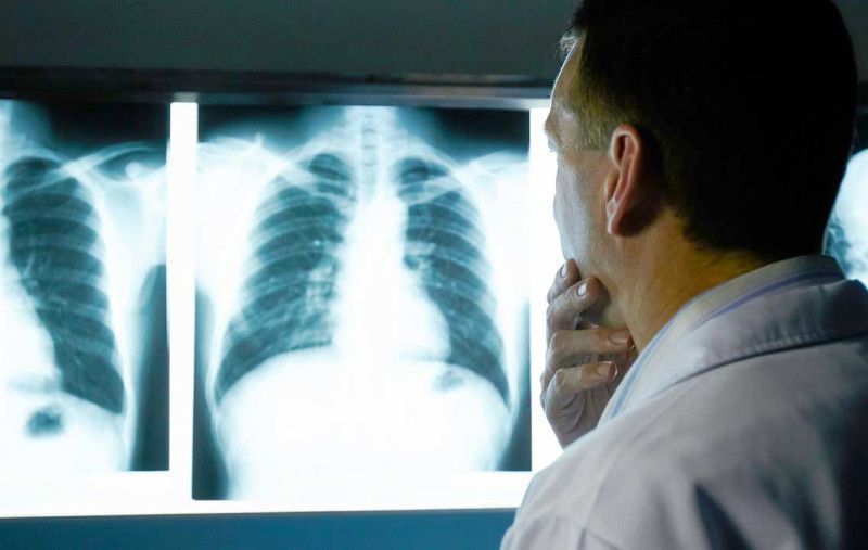 Médicos especialistas de Santiago advierten alto riesgo del uso de vape por jóvenes