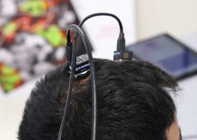 Restauran movimiento y tacto en un hombre tetrapléjico gracias a la inteligencia artificial