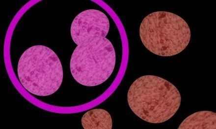 Inteligencia artificial para localizar el punto de origen de un cáncer