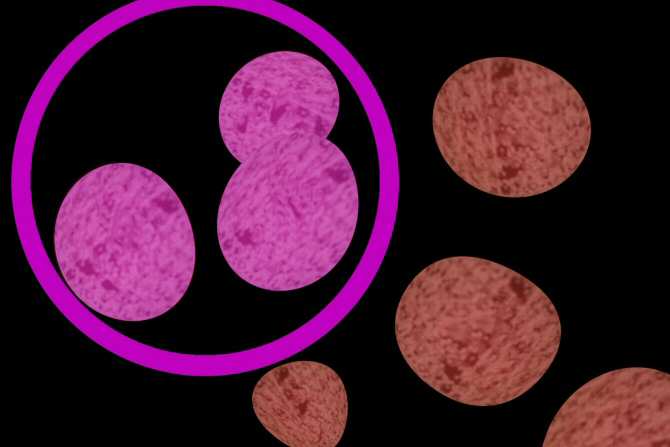 Inteligencia artificial para localizar el punto de origen de un cáncer