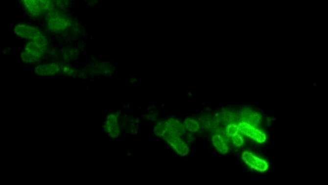 La forma de la bacteria y su capacidad para infectar