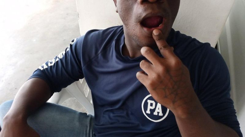 Dientes por deuda: “Yo no sé de dónde surgió esa modalidad de sacarle los dientes a alguien como castigo”