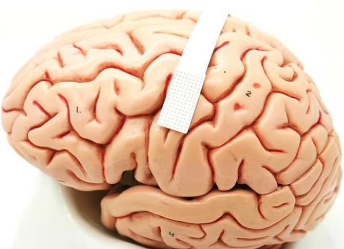 Interfaz cerebral que capta las palabras en las que piensa la persona