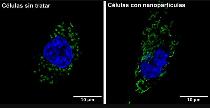 Nanopartículas de hierro contra células tumorales