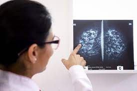 Disminuye en EE.UU. la mortalidad por cáncer, pero persisten las amenazas