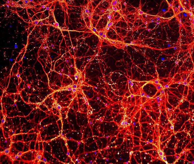 El asombroso parecido entre el universo a gran escala y el interior del cerebro
