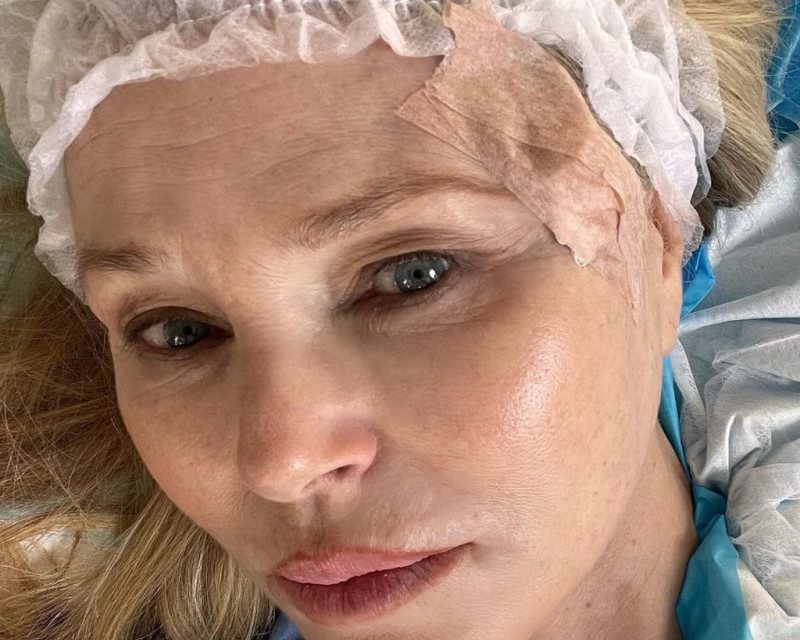 La modelo Christie Brinkley cuenta su experiencia con el cáncer de piel