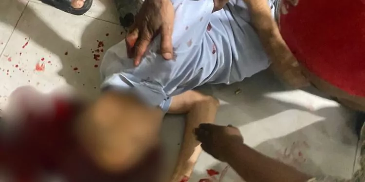 Está grave comerciante herido de un balazo en la cabeza por dos delincuentes en San Cristóbal