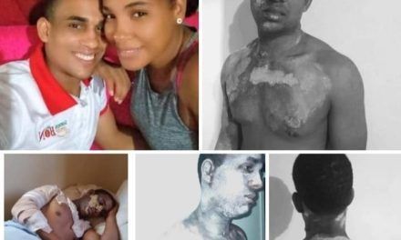 Mujer le lanza agua caliente a su expareja en San Cristóbal; resultó con graves quemaduras
