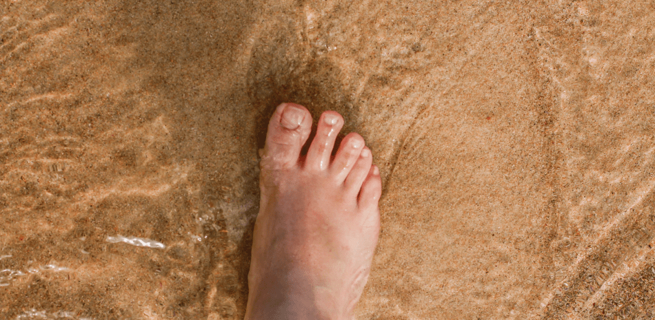 Los pies también sufren en el verano, expertos recomiendan colocarse protector solar