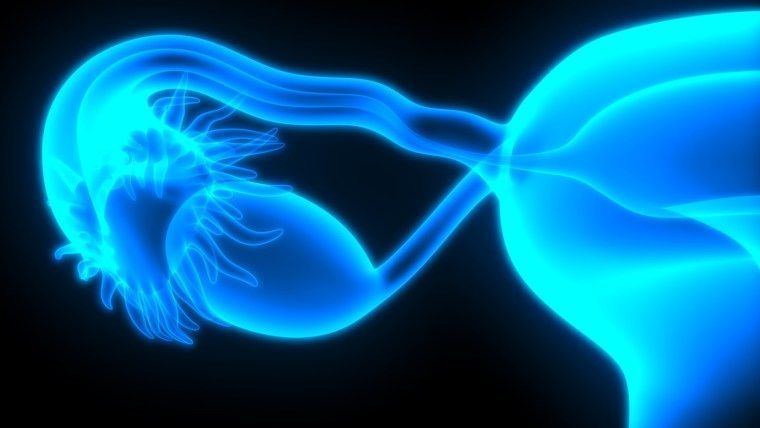 Cáncer de ovario: Historia de Consuelo Sáez, un testimonio que puede salvar vidas