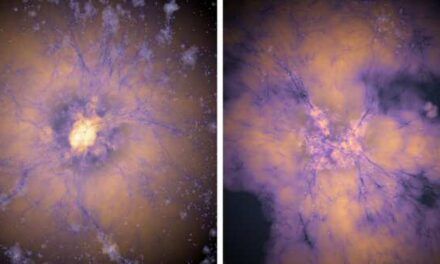 Lo que hizo una forma arcaica de energía oscura en la infancia del universo