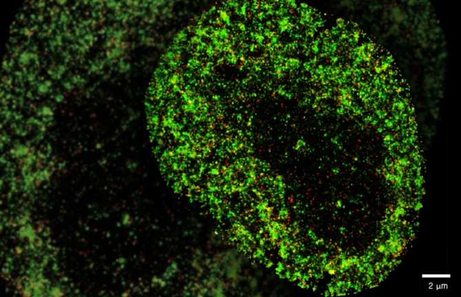 La inteligencia artificial detecta el cáncer y las infecciones virales con precisión nanométrica