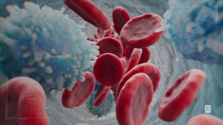 Mieloma múltiple, tipo de cáncer de médula ósea que aumentó en últimos 20 años