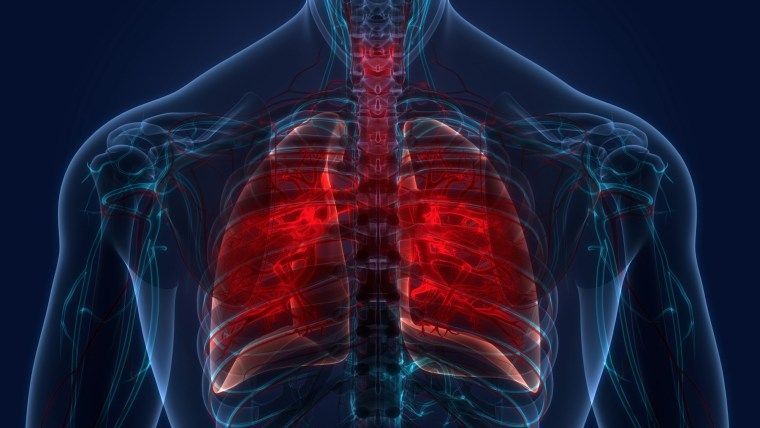 La tuberculosis supera el covid-19 y vuelve a ser la enfermedad infecciosa mortal
