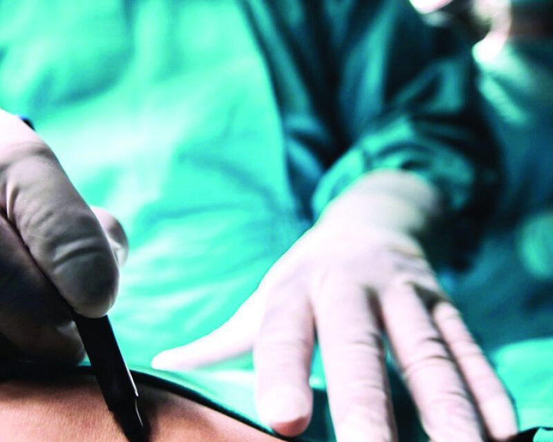 Cirugía plástica: Tres técnicas para lograr armonía corporal a través de una espalda definida